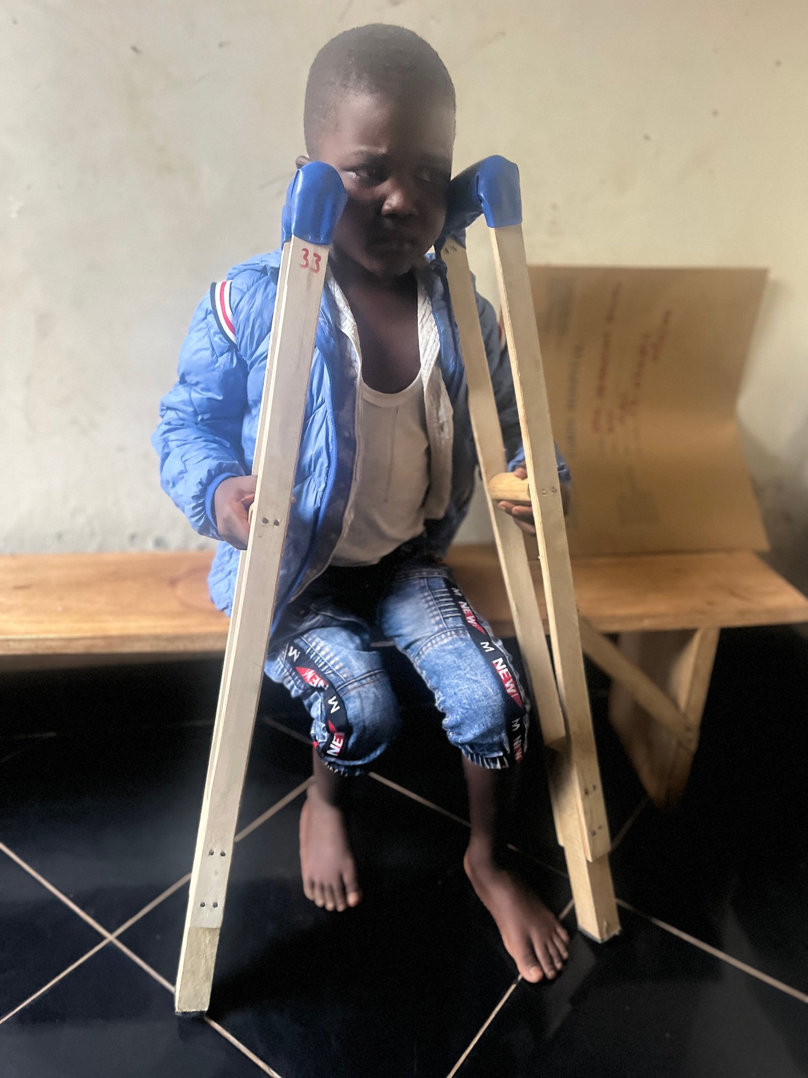 Otim Elijah’s treatment for sickle cell 